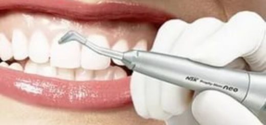 Профессиональная чистка зубов – ваша белоснежная улыбка