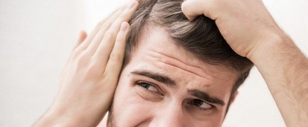 Проблема выпадения волос у мужчин и ее решение